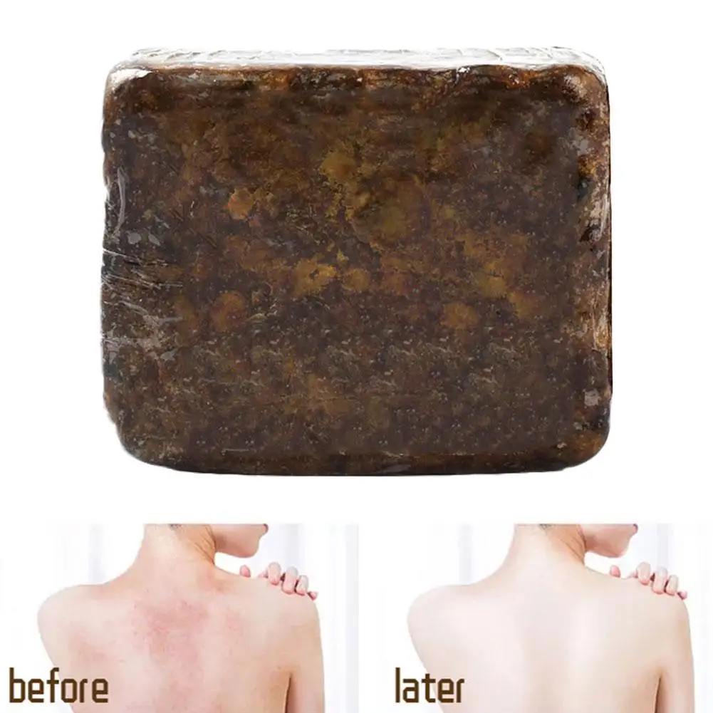 1 * Beauty Black Soap African Black Soap Dark Black Skin Lightening Soap 2025 new Brighten Face Body Skin Beauty Bath Body Bleaching Soap