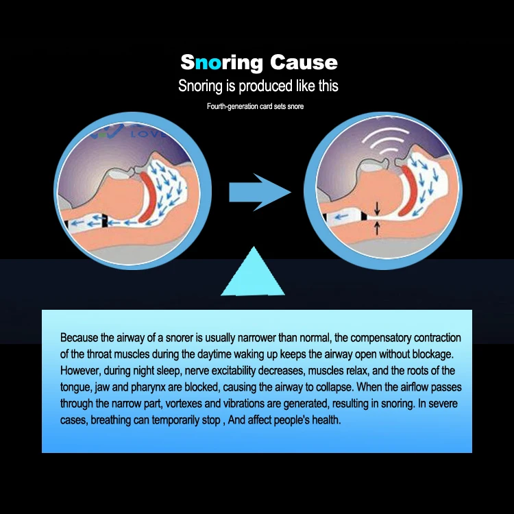 Silicone Anti Snoring Tongue RetainingSleep Breathing Apnea Night Guard Aid Stop Tongue Retainer Anti Snoring Mouthpiece