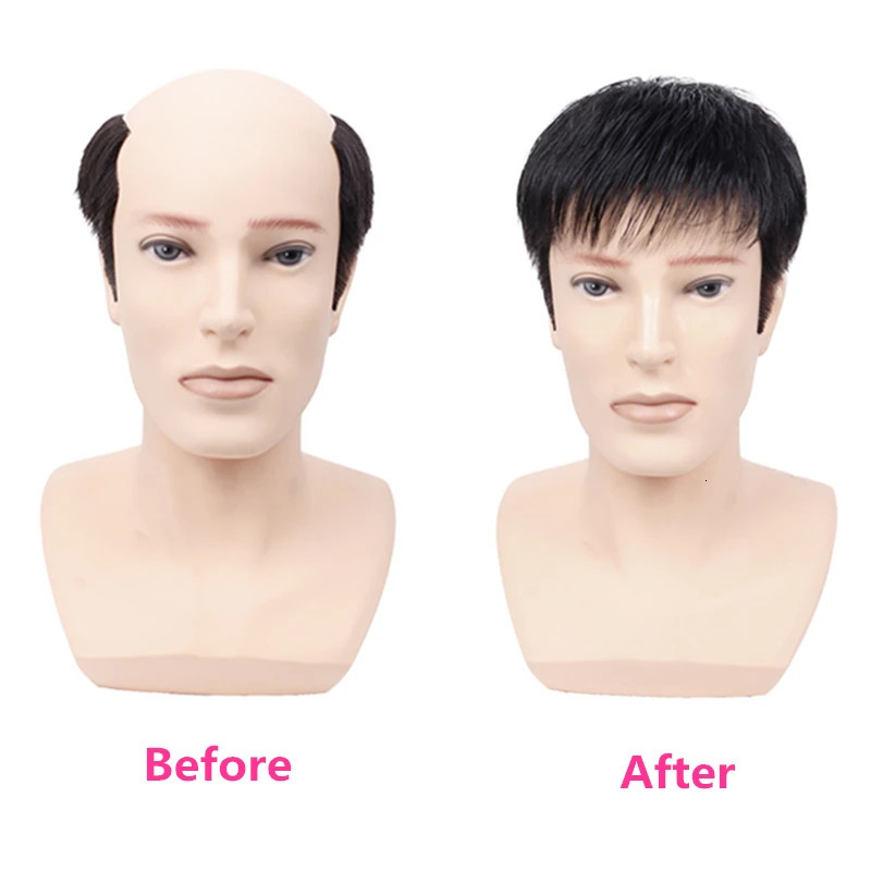 Prosthetic Hair Male 100% Human Hair Toupee Wigs for Man Replacement System Mens WIg Real Hair for Baldness Cover White Hair 241108