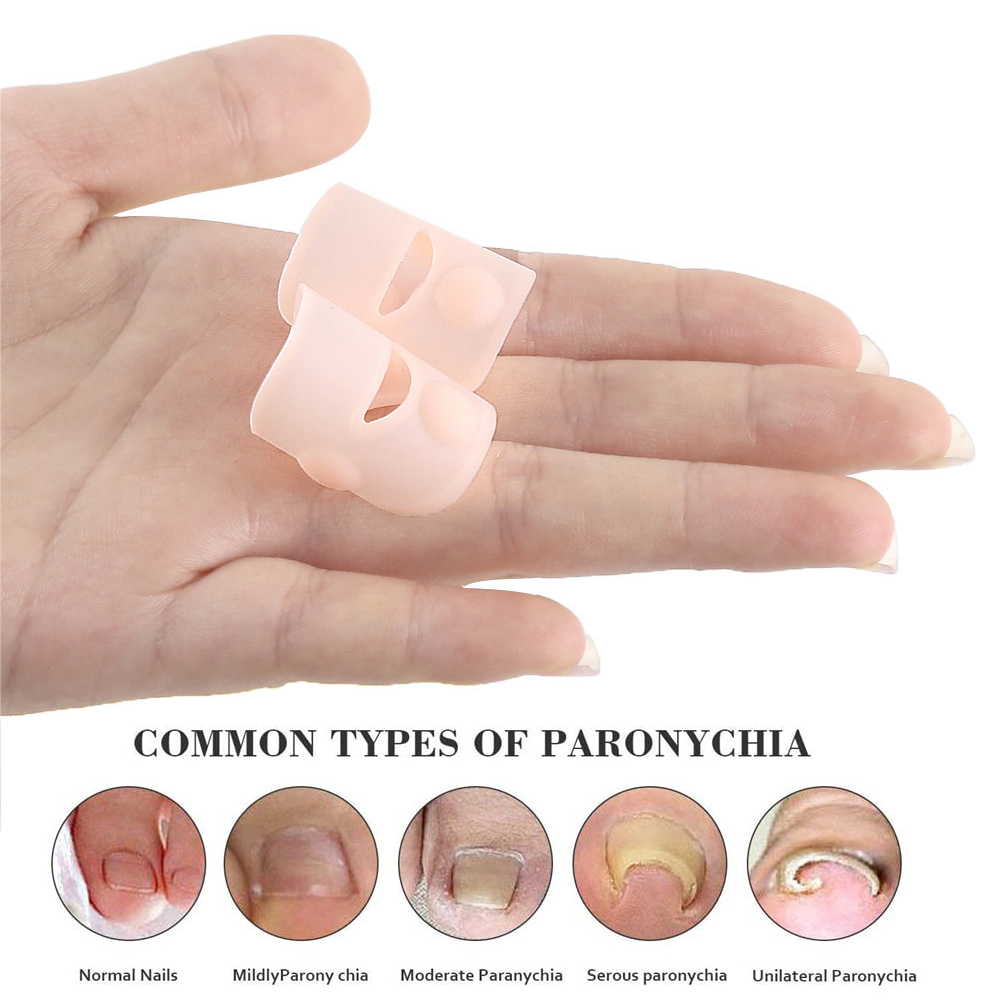 Pexmen 2/4/10Pcs Gel Ingrown Toenail Corrector Sleeves Big Toe Nail Healing Care Protectors Paronychia Treatment Pedicure Tool