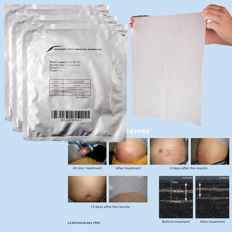 Mask Antifreeze Fat Membrane Film Anti Cooling Gel Pad Cryo Therapy Paper For hine