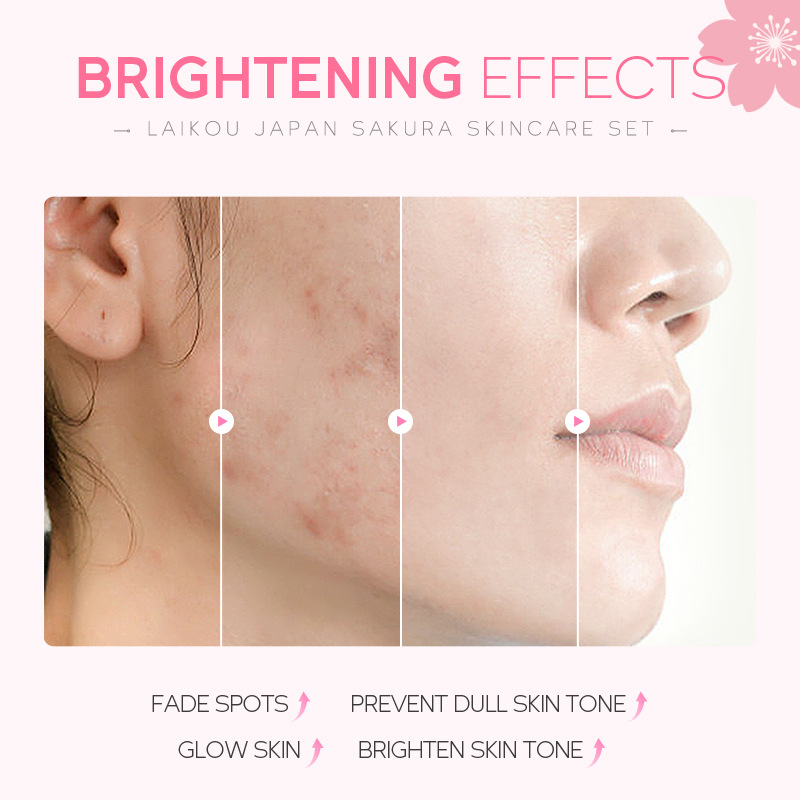Sakura Skin Care Sets Face Cream Eye Cream Facial Cleanser Acne Blackhead Remover Korean Cosmetics Face Care Eyes Care Skincare