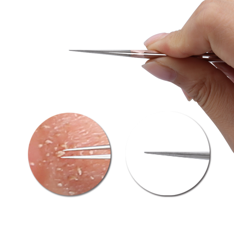 e Blackhead Brainbow Tweezers pcs Remover Acne Treatment Needle Spot Cleaner Pimple Blemish Extractor Skin Clean Care Tools Kit