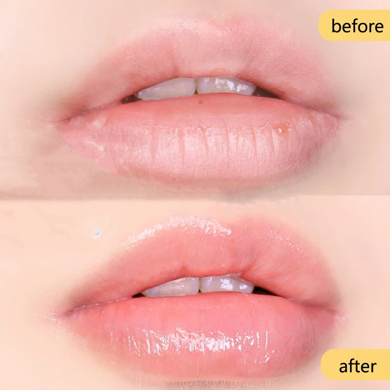 Ooriginal Vaseline Lip Balm Moisturizing Anti-Cracking Petroleum Jelly Lipbalm Lipstick Base Korean Cosmetic Skin Care Products