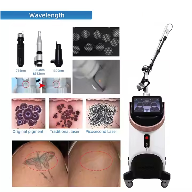 Beauty Trends Picolaser Nd Yag Tattoo Removal q switched freckles pigment remove Picosecond Laser Machine