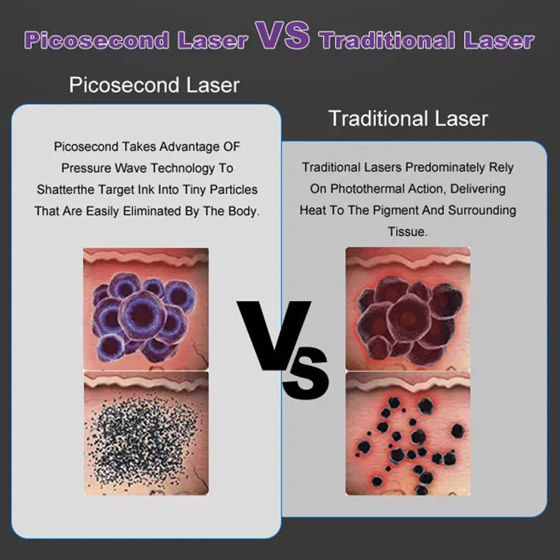 Vertical pico laser q switched 532nm 1064nm all color pigment removal nd yag picosecond tattoo remove device