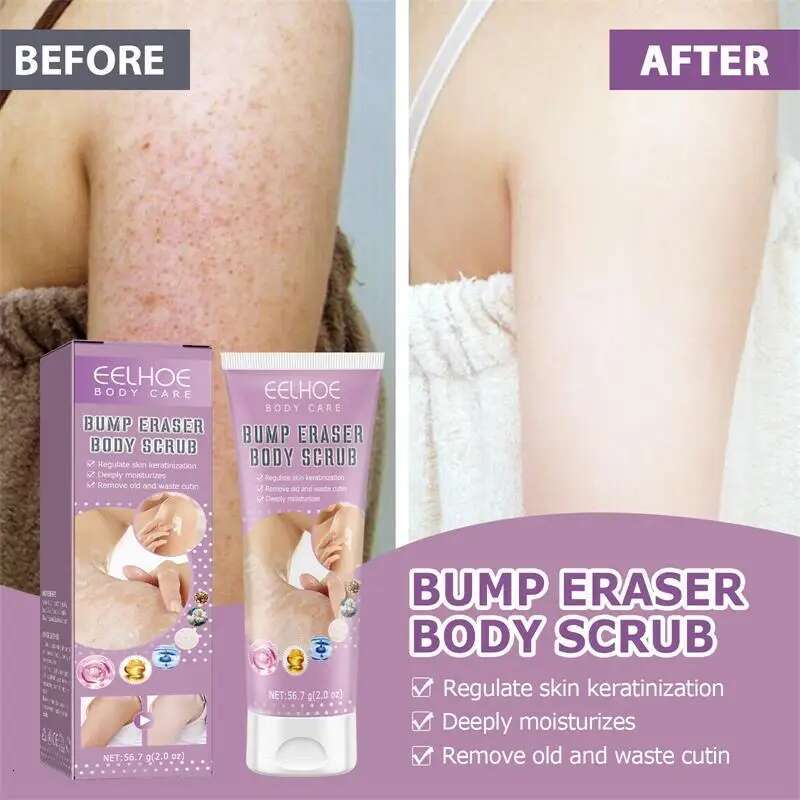 Moisturizing Scrub Keratin Hyperplasia Removing Strawberry Legs Repairing Nourishing Body Skincare Products