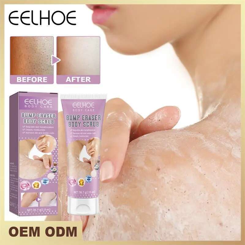 Moisturizing Scrub Keratin Hyperplasia Removing Strawberry Legs Repairing Nourishing Body Skincare Products