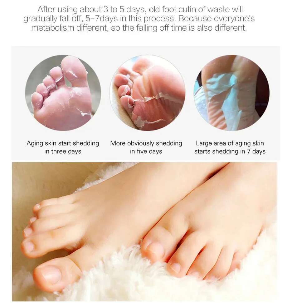 Aloe Vera Peeg Legs Feet Mask Scrub Exfoliating Soc for Pedicure Anti Crack Heel Remove Skin Foot Patch