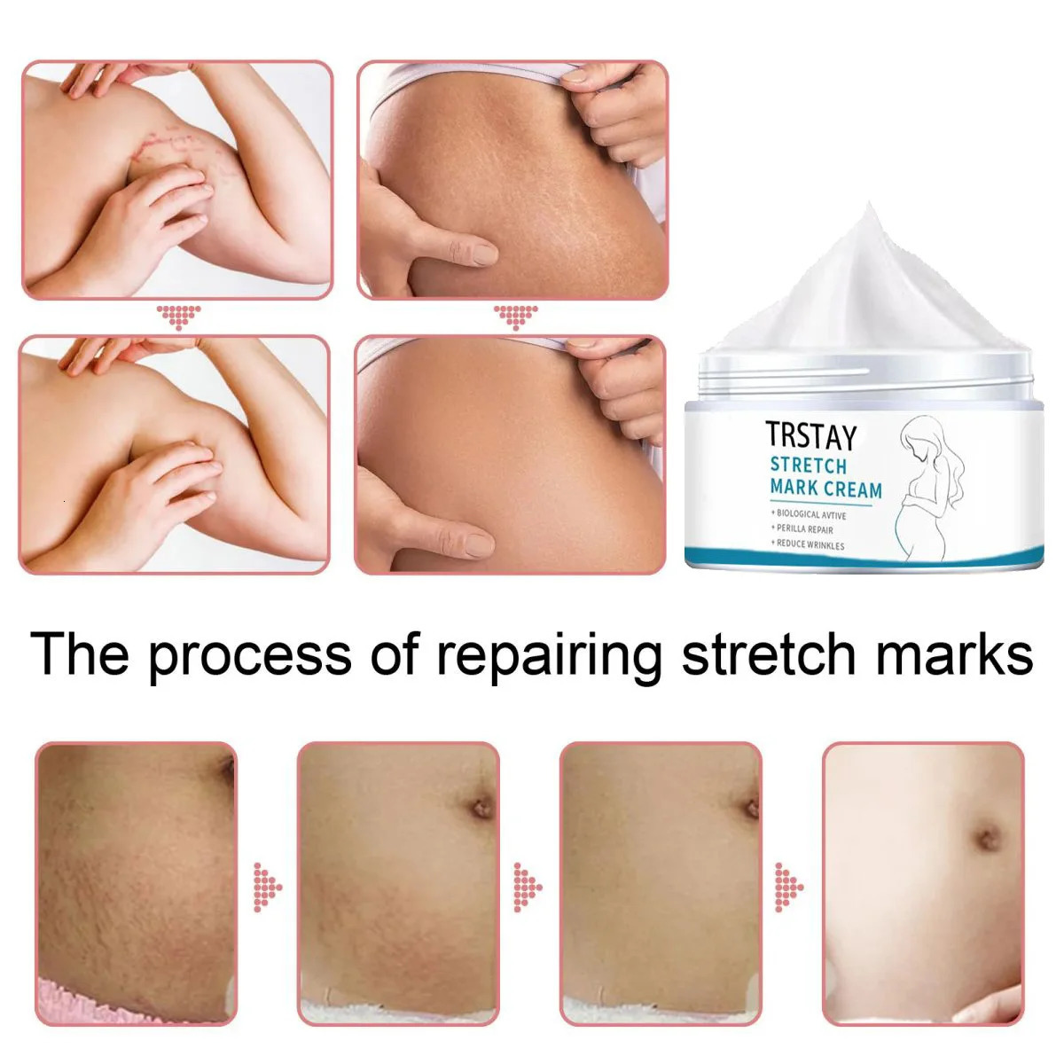 Pregnant Woman Stretch Mark Repair Cream Postpartum and Fade Marks To Prevent Obesity Moisturizing Skin Care 241112