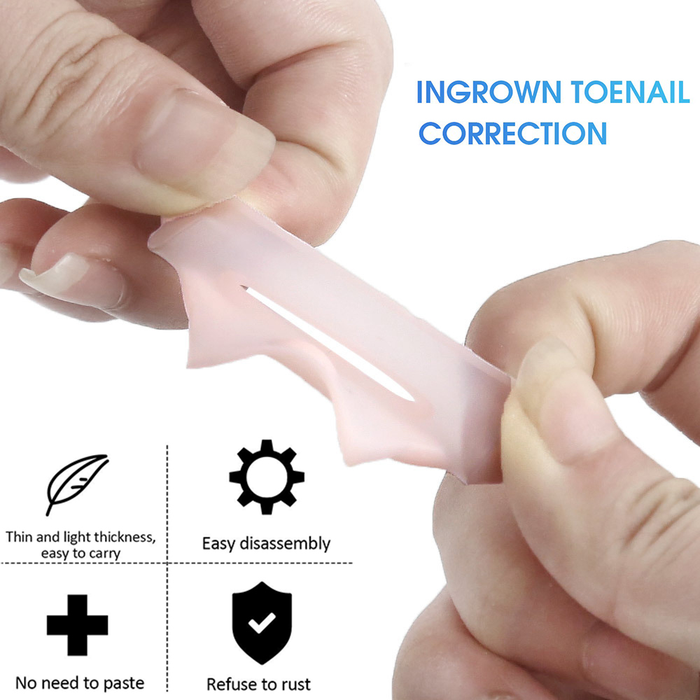 Pexmen 2/4/10Pcs Gel Ingrown Toenail Corrector Sleeves Big Toe Nail Healing Care Protectors Paronychia Treatment Pedicure Tool
