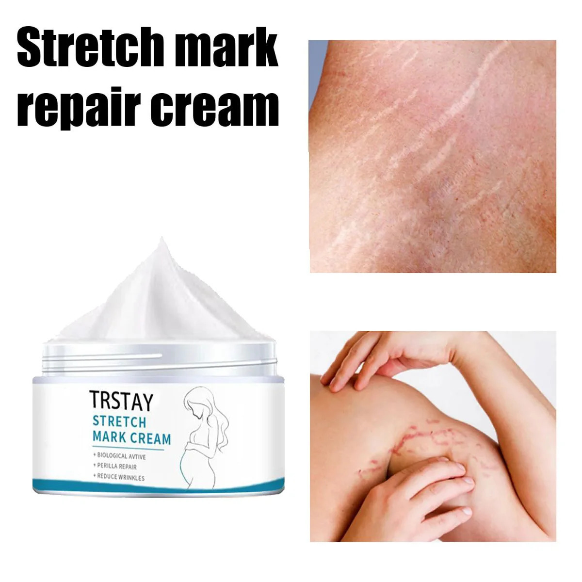 Pregnant Woman Stretch Mark Repair Cream Postpartum and Fade Marks To Prevent Obesity Moisturizing Skin Care 241112