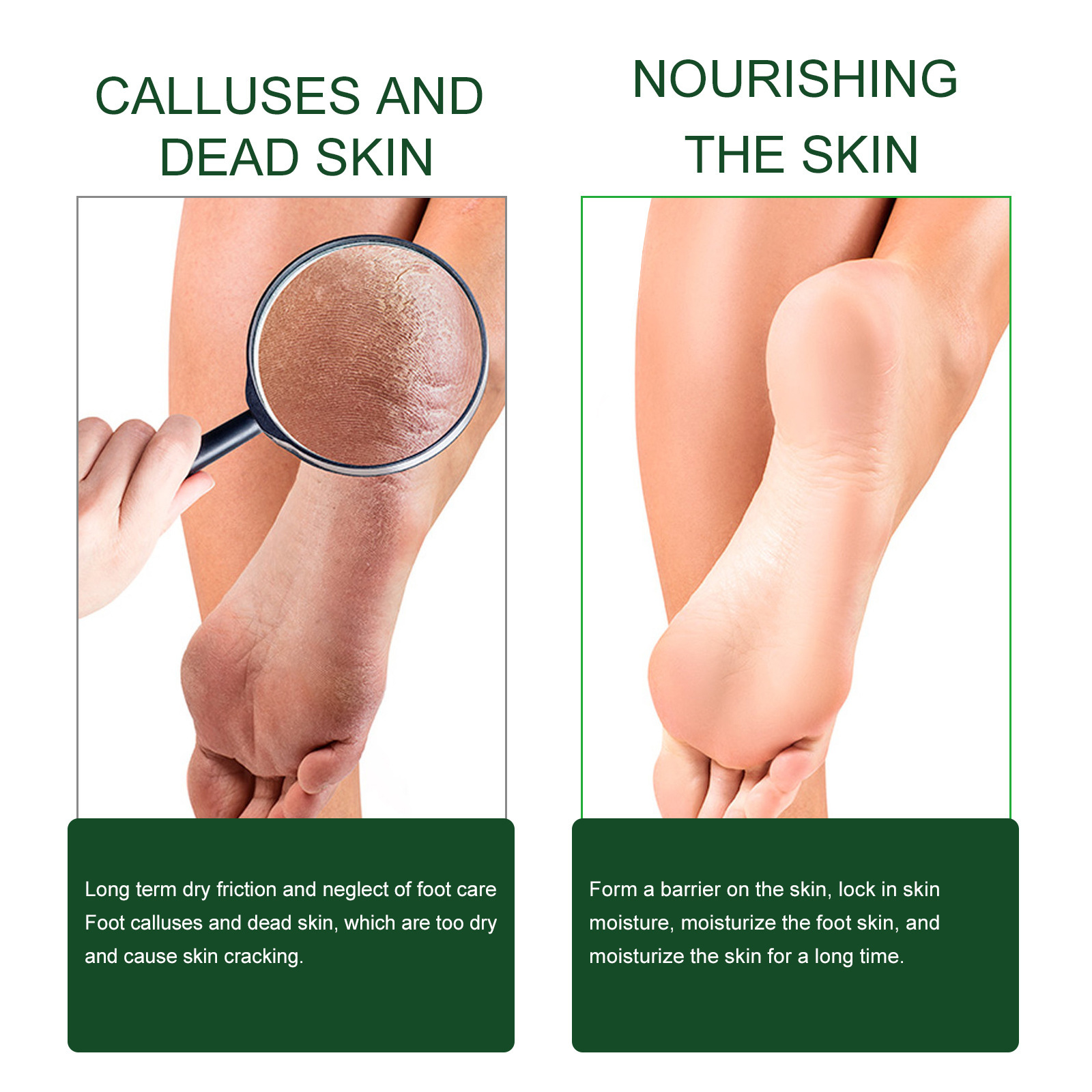 Foot Repair Cream Cracked Anti Drying Chapped ddmysmile Heel Soften Callus Dead Skin Removal Tea Tree Oil Nourishing Feet Treatment Cream Smile
