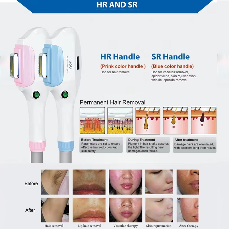 360 magneto-optic IPL Hair Removal Beauty Skin Pico Laser Tattoo Removal Machine Nd Yag Laser System OPT RF