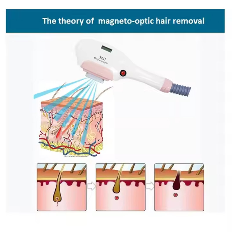 NEW Arrival IPL hair removal opt elight 4 handles rf face lifting q switch tattoo removal nd yag laser machine