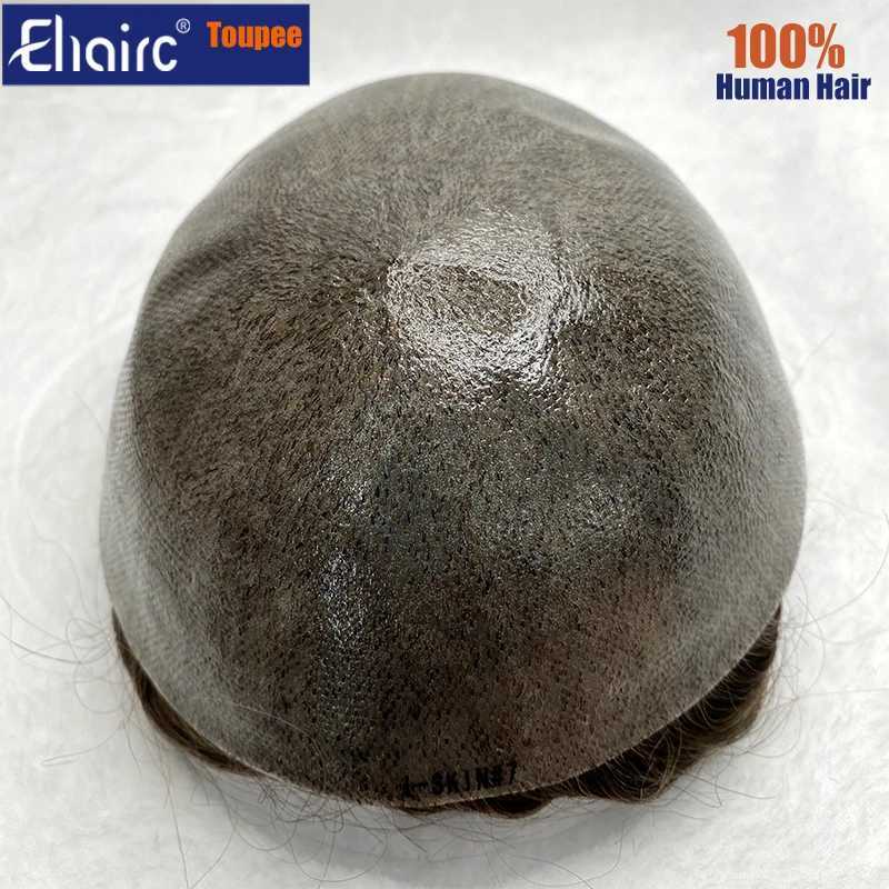 S-Men Calcium Prothesis 0.12-0.14mm Injection Skin M Hair ProsesisToupee Mens 6-inch Wig System M241118
