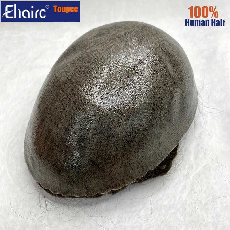S-Men Calcium Prothesis 0.12-0.14mm Injection Skin M Hair ProsesisToupee Mens 6-inch Wig System M241118