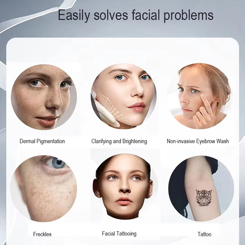 Multi-function Picosecond Q Switched Nd Yag Tattoo Removal Freckle Remover Eyebrow-washing Laser Device