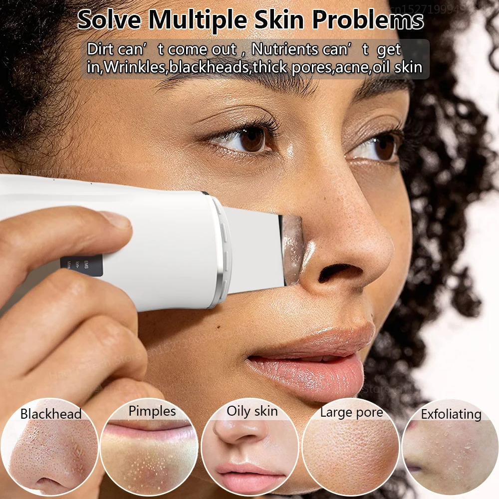 Blackhead r Ultrasonic Skin Scrubber Pore Peeling Spatula Blackhead Removal Shovel Face Deep Cleaning Device 250523