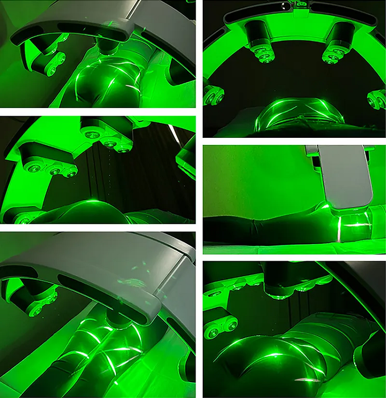 10D Maxlipo 532nm Green Light Lipo Laser Slimming Lipolaser Non-invasive 532nm Laser Green Light Fat Removal Cellulite Removal Body Shape Slimming 10d