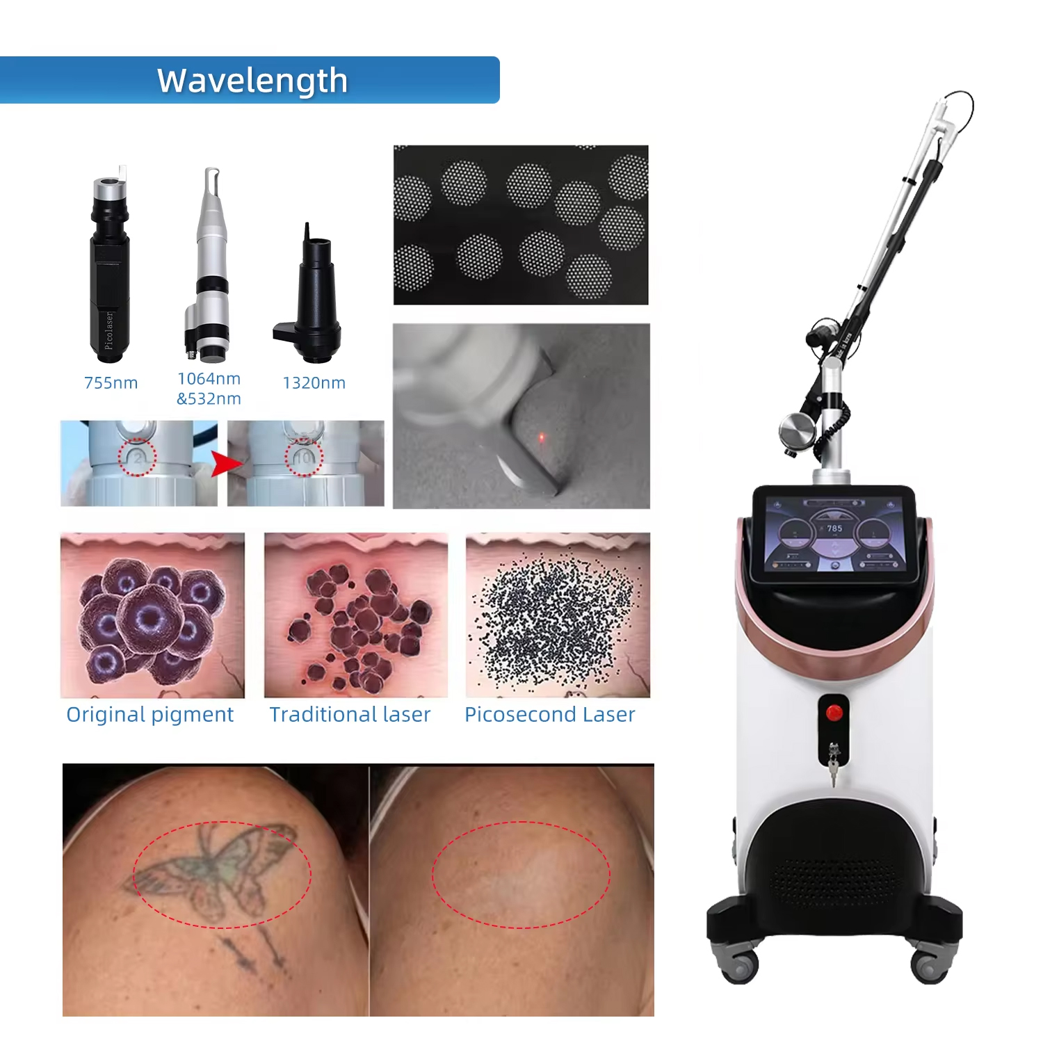 Advanced Super Picosecond Laser Tattoo Removal Professional Skin Whitening Super Picolaser 532nm 785nm 1032nm 1064nm Laser Spot Removal Machine