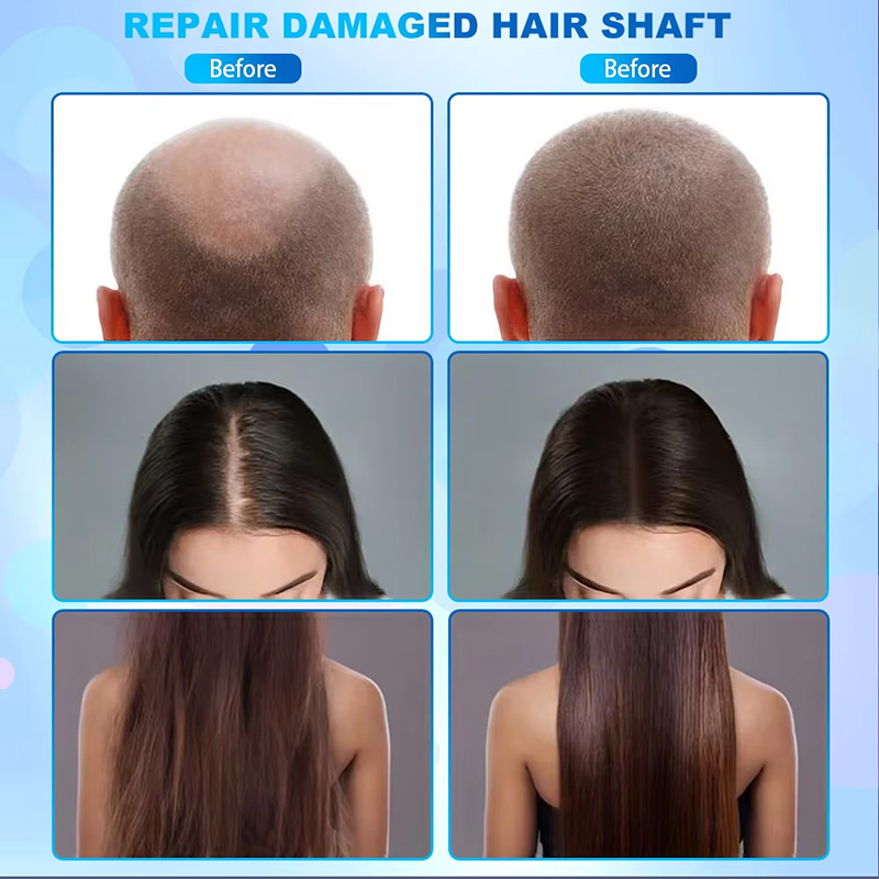 Scalp Massage/scalp analyzer High Frequency Device hair care comb hair scalp test machine for salon use