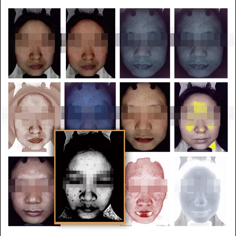 Professional 2 In 1 AI 3D Imaging Skin Analysis Health Problem Detection Wrinkle Acne Crinkle Pore Moisture Testing 36 Million Pixels Skin Detection M