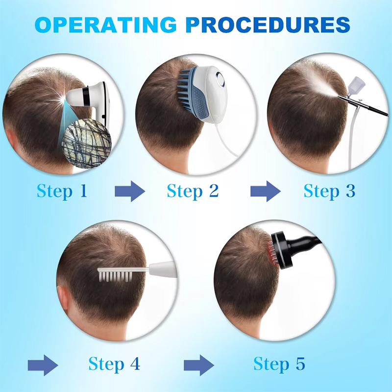 Scalp Massage/scalp analyzer High Frequency Device hair care comb hair scalp test machine for salon use