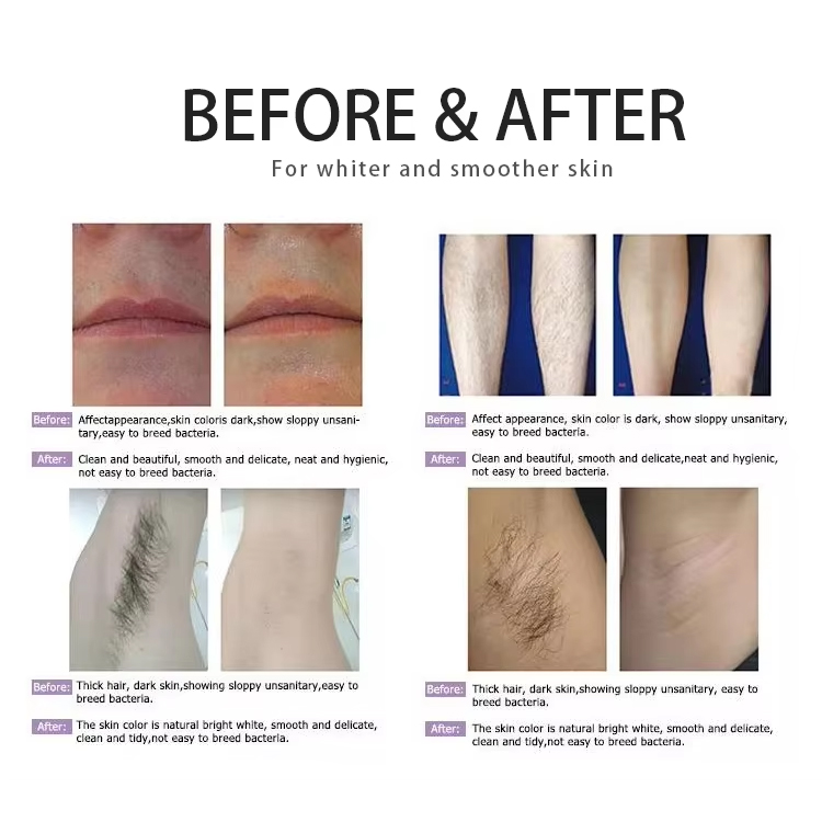 2025 New Diode Laser 810 Hair Removal Ice Permanent Depilation No Pain No Scar Powerful Laser Hair Removal Skin Rejuvenation Salon Use Machine