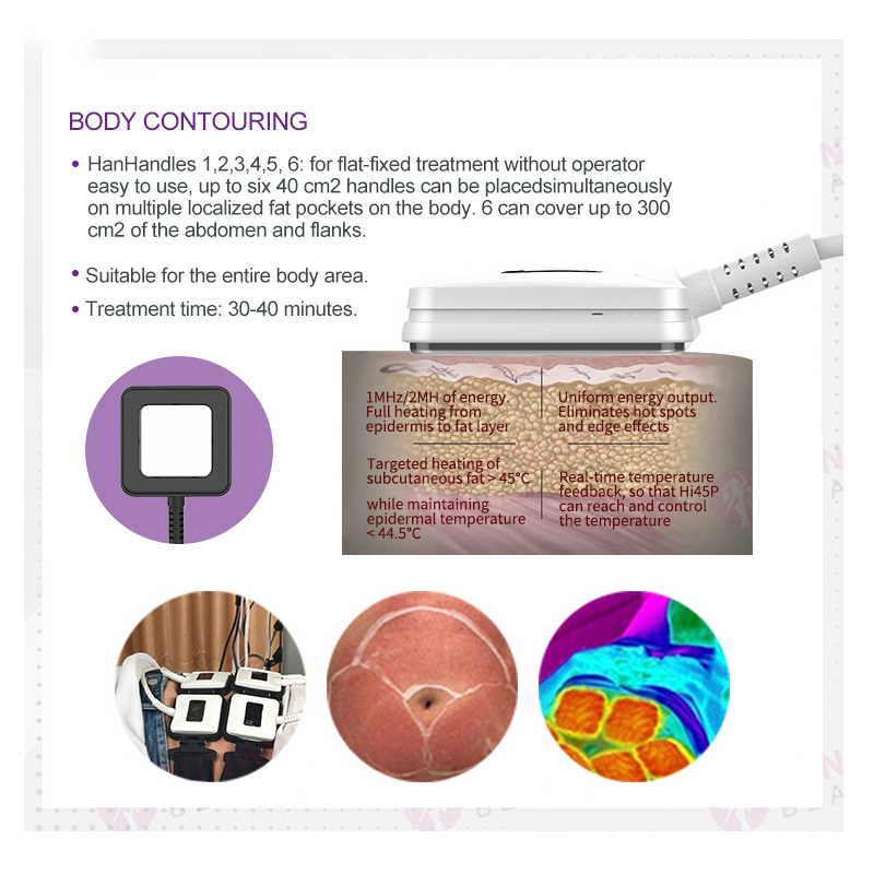 Free shipment trusculpt id machine rf sculpting body body contouring machine