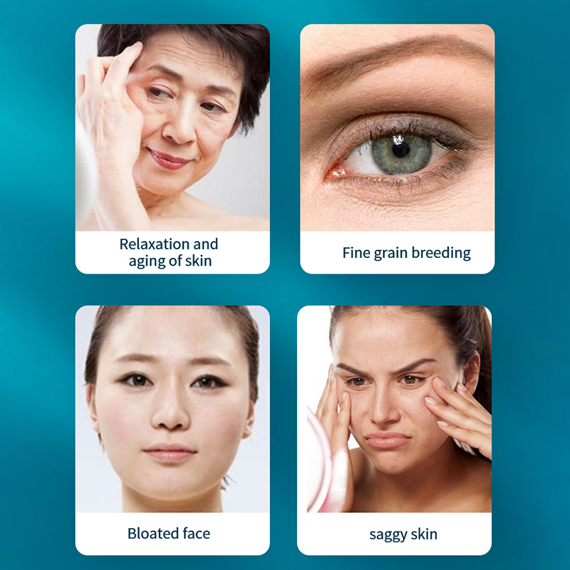 Layered anti aging beauty microcurrent skin lifting radiofrequency heating No-cartridge Vmax instrument
