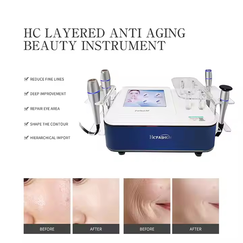 Layered anti aging beauty microcurrent skin lifting radiofrequency heating No-cartridge Vmax instrument