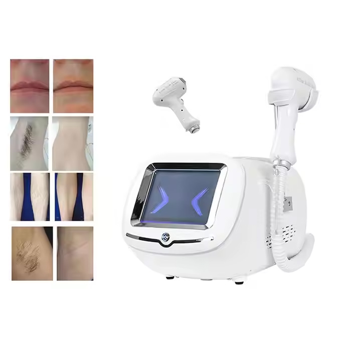 OEM Epilator Diode Laser 755 810 1064nm Ice Epilation Permanent Hair Remover Beauty Hair Removal Laser Beauty Equipment