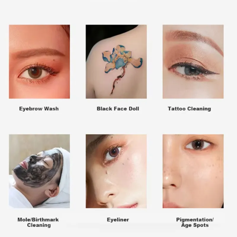 Factory Outlet Q Switched Nd Yag Pico Second Laser Eyebrow Washing Freckle Remover Laser Tattoo Removal Machine