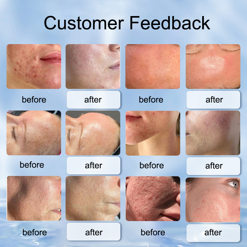 15 in 1 Hydra facial Machine Hydro Dermabrasion face lifting Peeling Ultrasonic Skin Scrubber Oxygen Spray Skin Care Microdermabrasion
