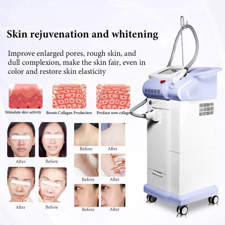 Portable diode laser 2000W professional laser hair removal 808 diode laser permanent hair-removal machine laser skin rejuvenation whitening equipment