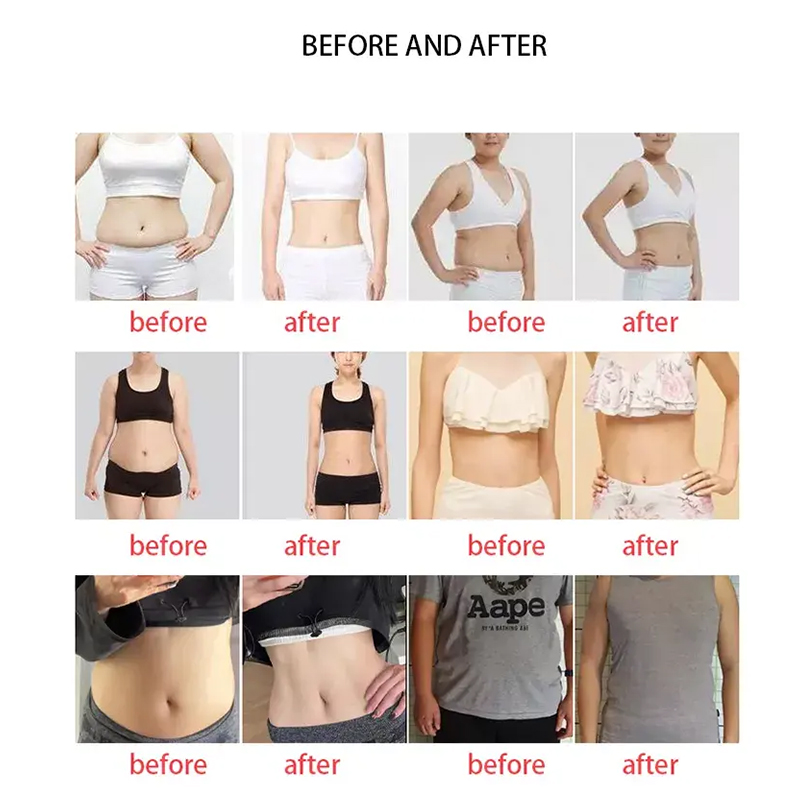 2024 Technology Portable Ice Cool Hifu Machine High Power Vmax Focused Smas Lifting Eye Care Hifu Machine