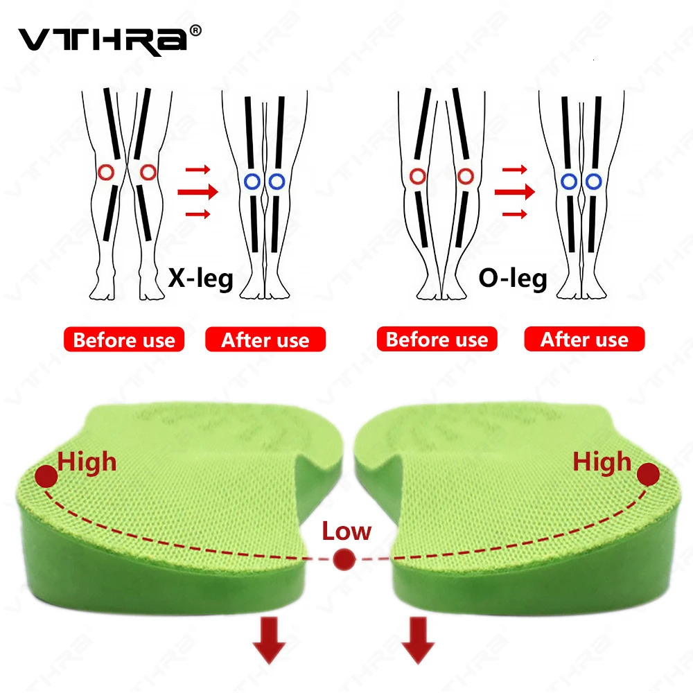 O/X-Leg Orthodontic Insert Arch Support Insert Corrigibil Bow Leg Valgus Varus Massage insole Beauty Leg Care Insert 240612