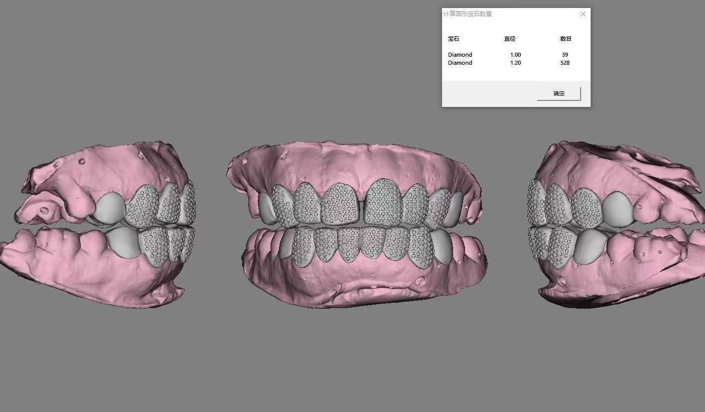Iced Out Grillz straight zigzag micro hand setting VVS D color Moissanite fully Diamonds Teeth Grillz