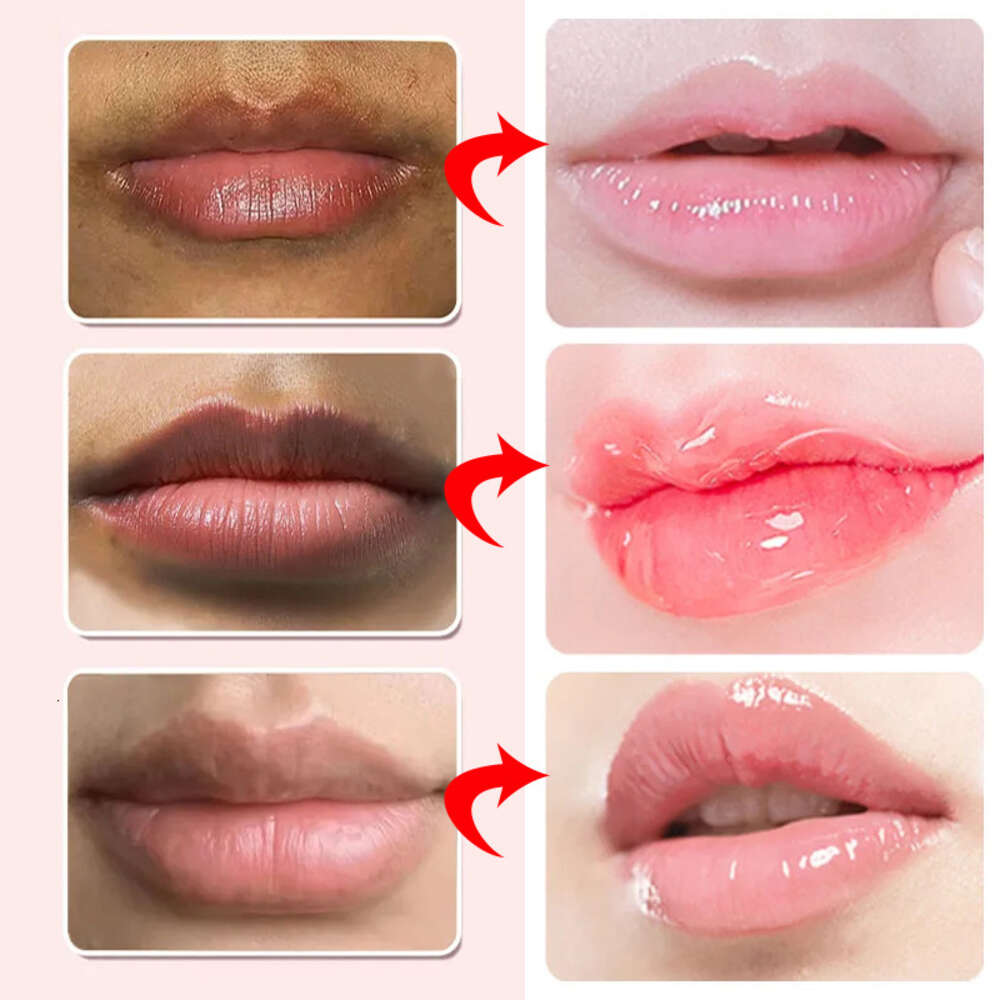 Balm Remove Dark Lip Moisturizing Lightening Melanin Whitening Plumper Extreme Gloss Pink Lips Skin Care For Men Women F620-7