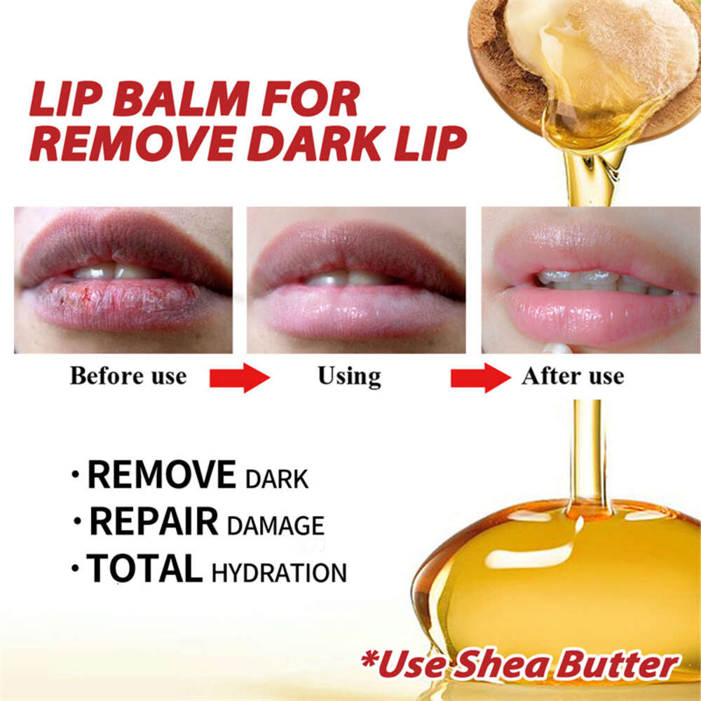 Balm Remove Dark Lip Moisturizing Lightening Melanin Whitening Plumper Extreme Gloss Pink Lips Skin Care For Men Women F620-7