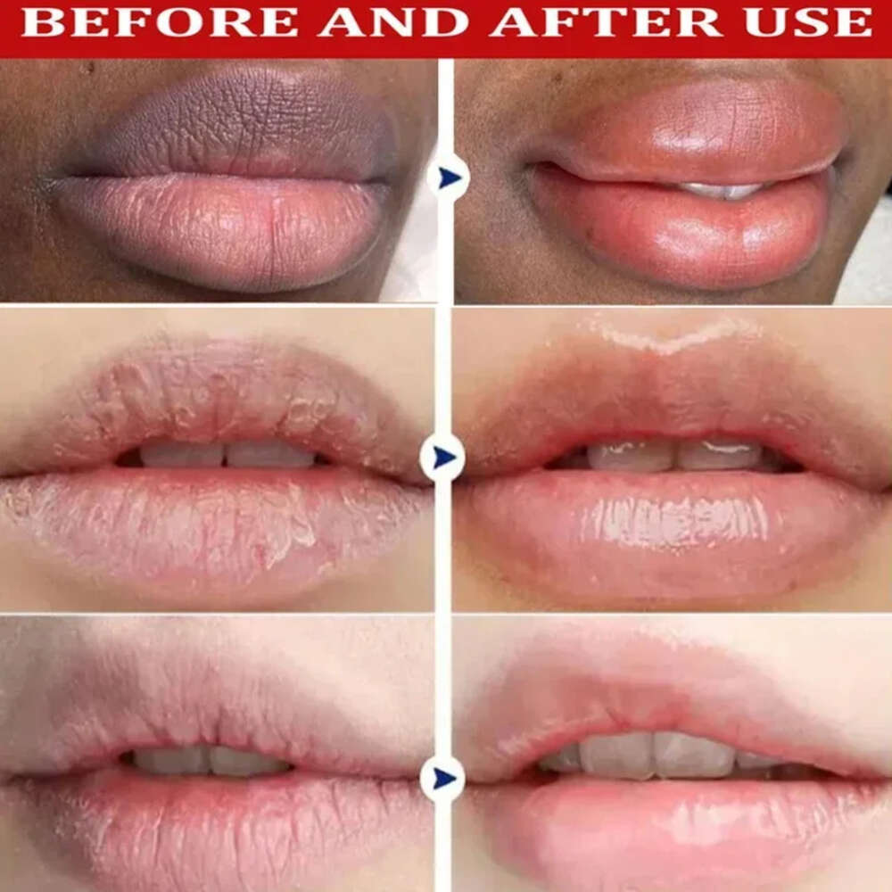 Remove Dark Lip Balm Lightening Melanin Mask Gloss Oil Exfoliating Clean Moisturizer Korean Care Products Makeup Beauty Health F620-3