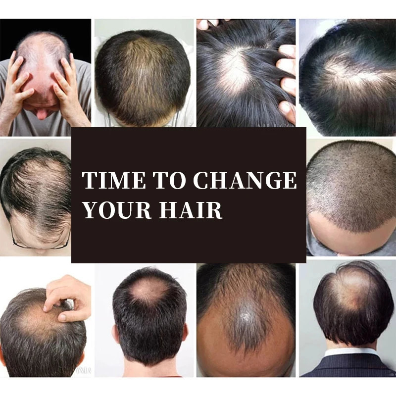 Mens Natural Black Short Wigs Straight Wig Hair Clip-on Toupee Hair Men The Top of The Head Wigs Replacement Wigs 240621