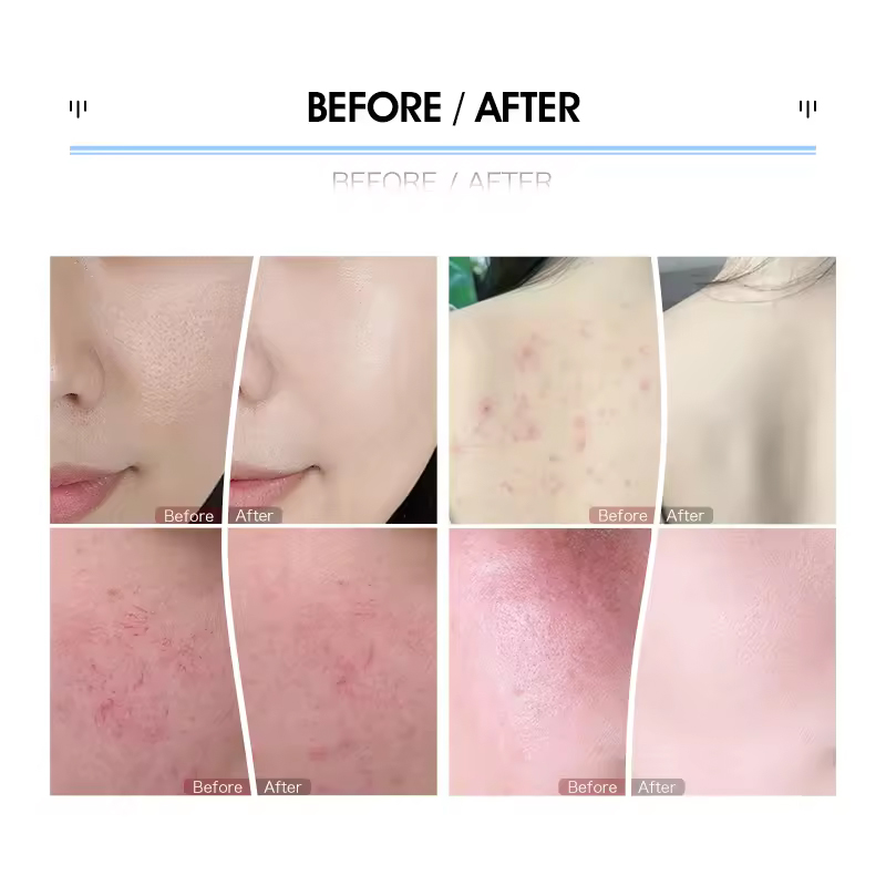 Vertical LED Light Therapy 7 Colors Photodynamic PDT Facial Skin Whitening Rejuvenation Tightening Care Machine