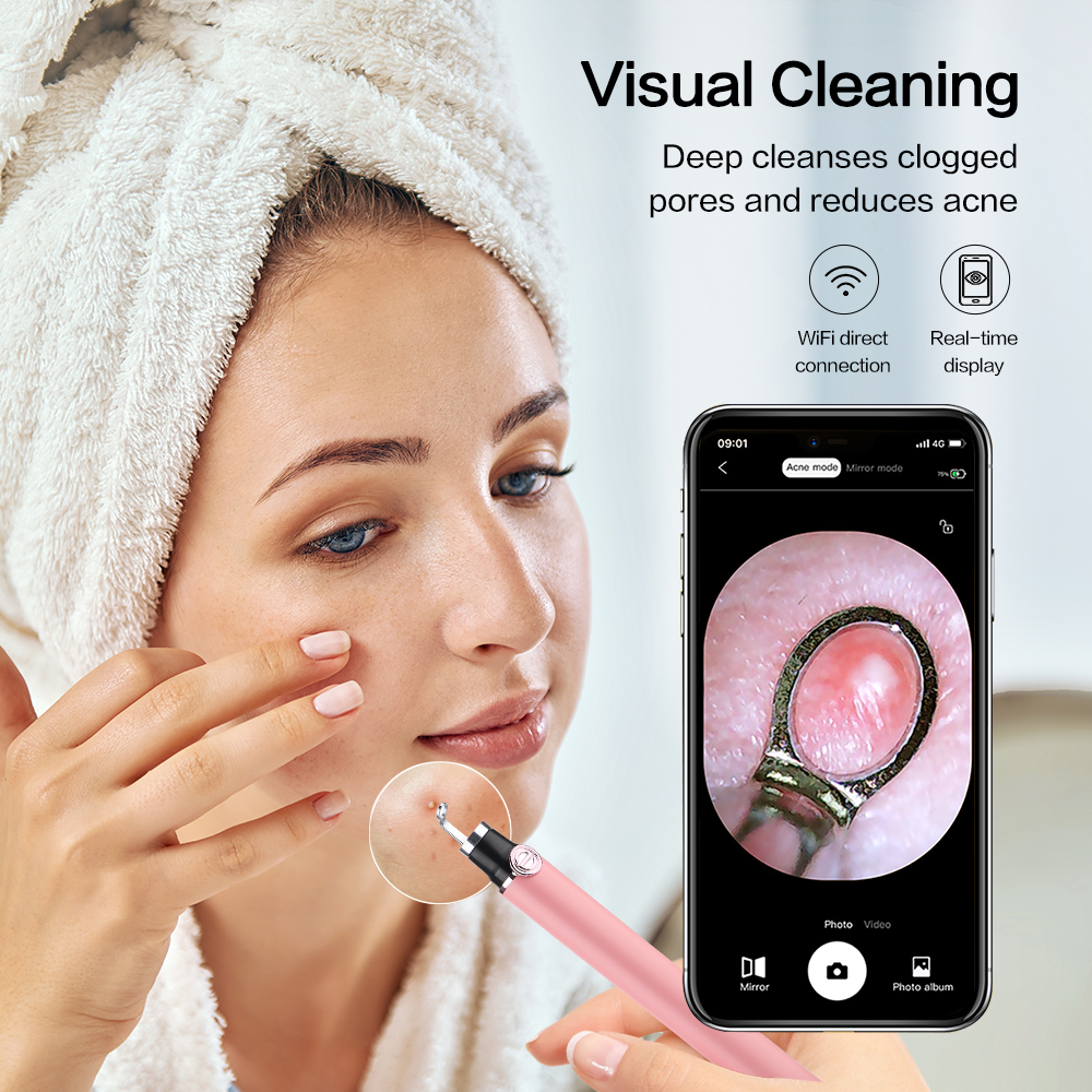 Visual Blackhead Remover Nose Black Head Acne Removal Pen Mini Camera Facial Cleaning Tools Extractor Pimples USB Charging