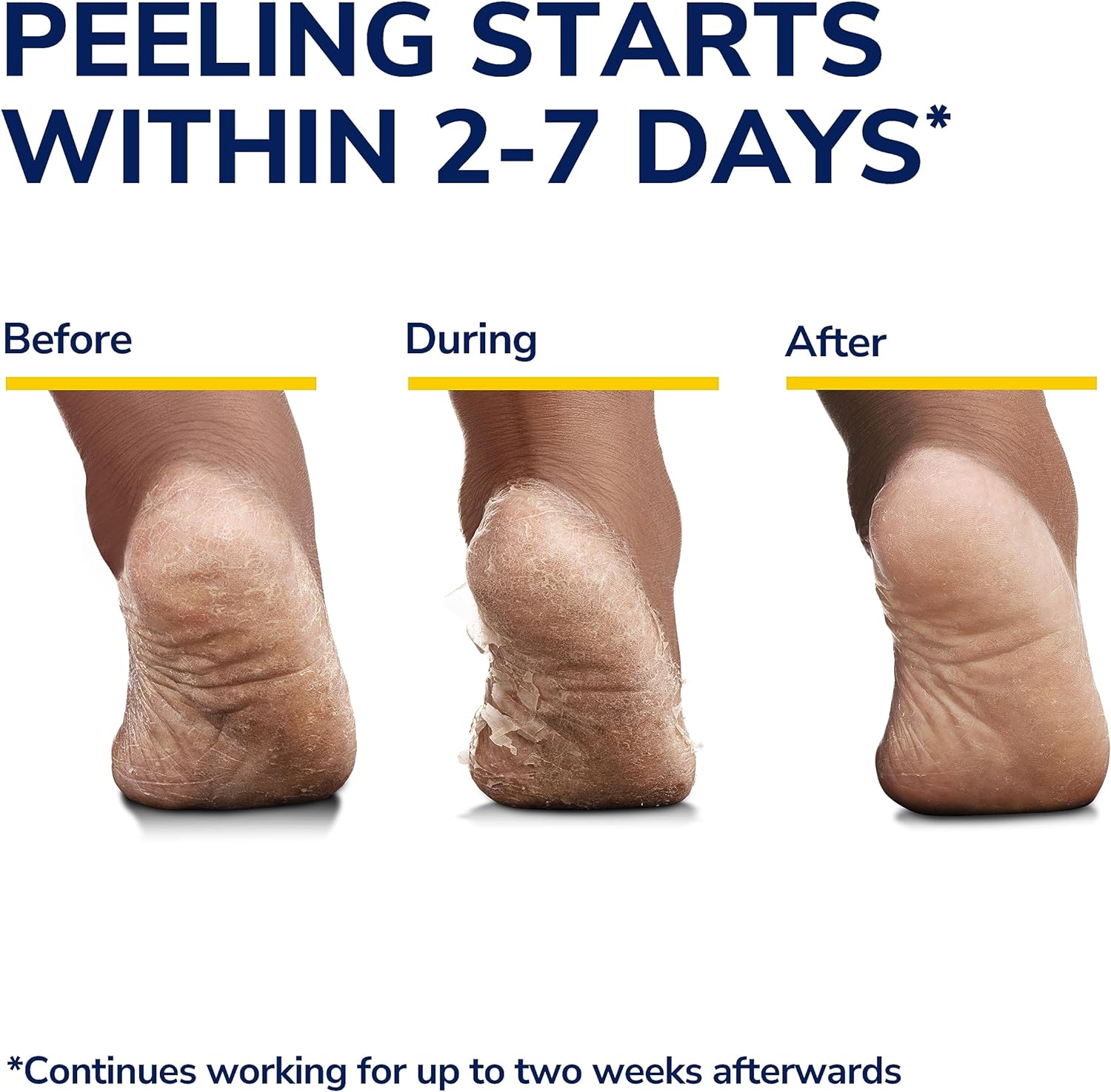 Peeling Off FlowWeek Peel Foot Mask, Peel Off Calluses and Dead Skin Removal Mask, Soft and Smooth Touch Feet for Men and Women, smile Mask, Mask, Wom