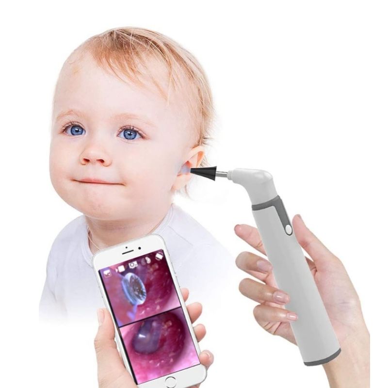 LMS CAP Otoscope Ear Camera 3.9mm Wifi Camera HD Video Inspect Borescope Digital Medical Otoscop for IOS Android Phone GIFT