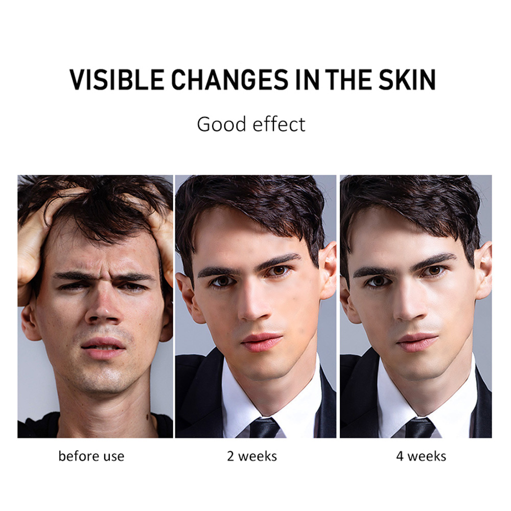 VEZE Hyaluronic Acid Men's Face Cream Oil-Control Anti-Wrinkle Deep Firming Shrink Pores Nourishing Cream Skin Care