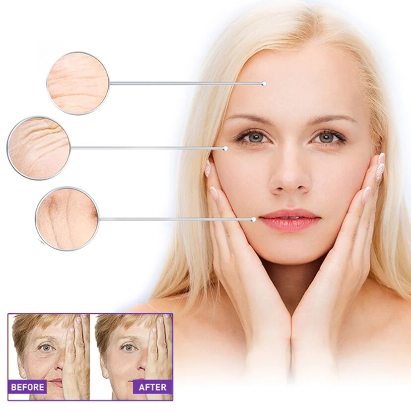 100pcsWrinkle Patch Face Wrinkle Patch Lift Face Firming Skin Droop Law Mouth Wrinkle Cheek Patch