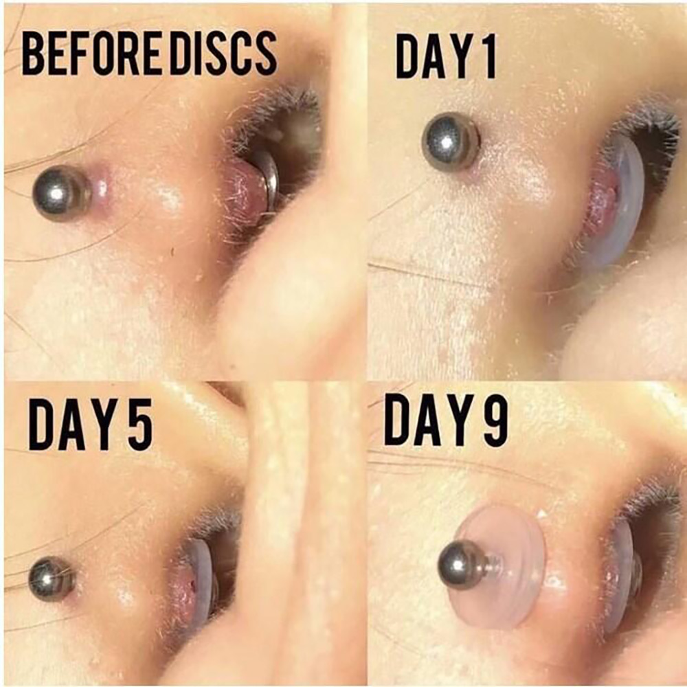 10pcs/lot Right Grand Silicone Piercing Healing Discs Flexible Anti Hyperplasia Saucer Ear Stud Lip Ring Nose Soft Gasket